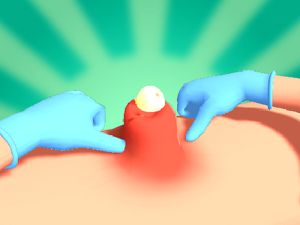 Xogo Pimple Squeeze en liña